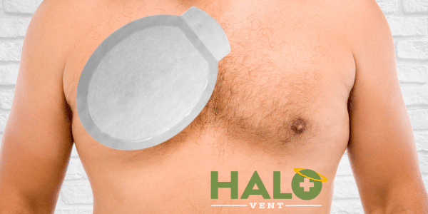 halo chest seal