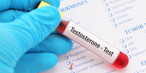 testosterone test