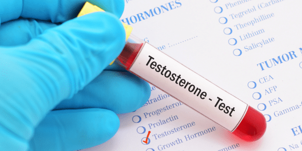 Taking the Everlywell TESTOSTERONE TEST Kit at HOME and