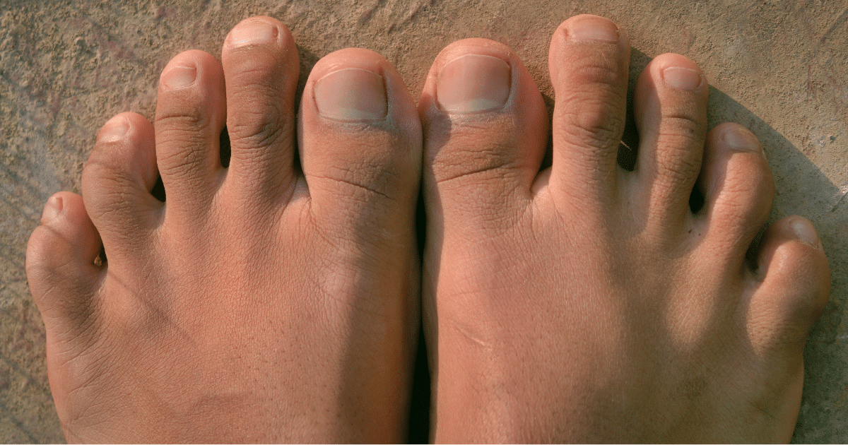 feet